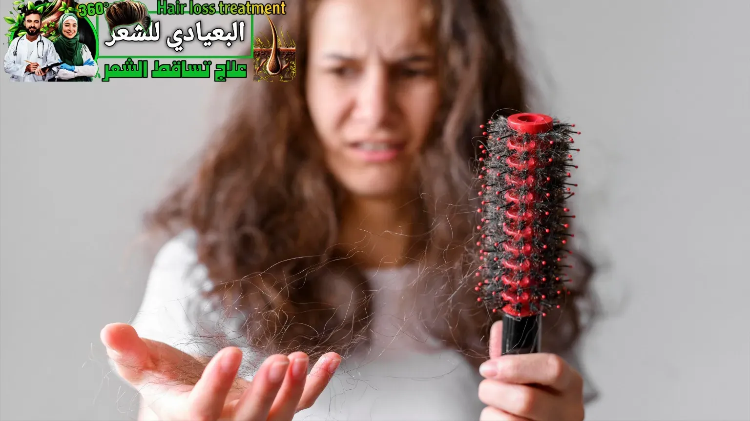 تساقط الشعر الناتج عن حبوب منع الحمل تساقط الشعر الناتج عن حبوب منع الحمل