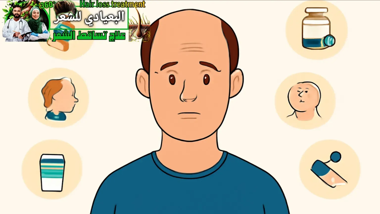 أسباب الصلع عند الرجال أسباب الصلع عند الرجال